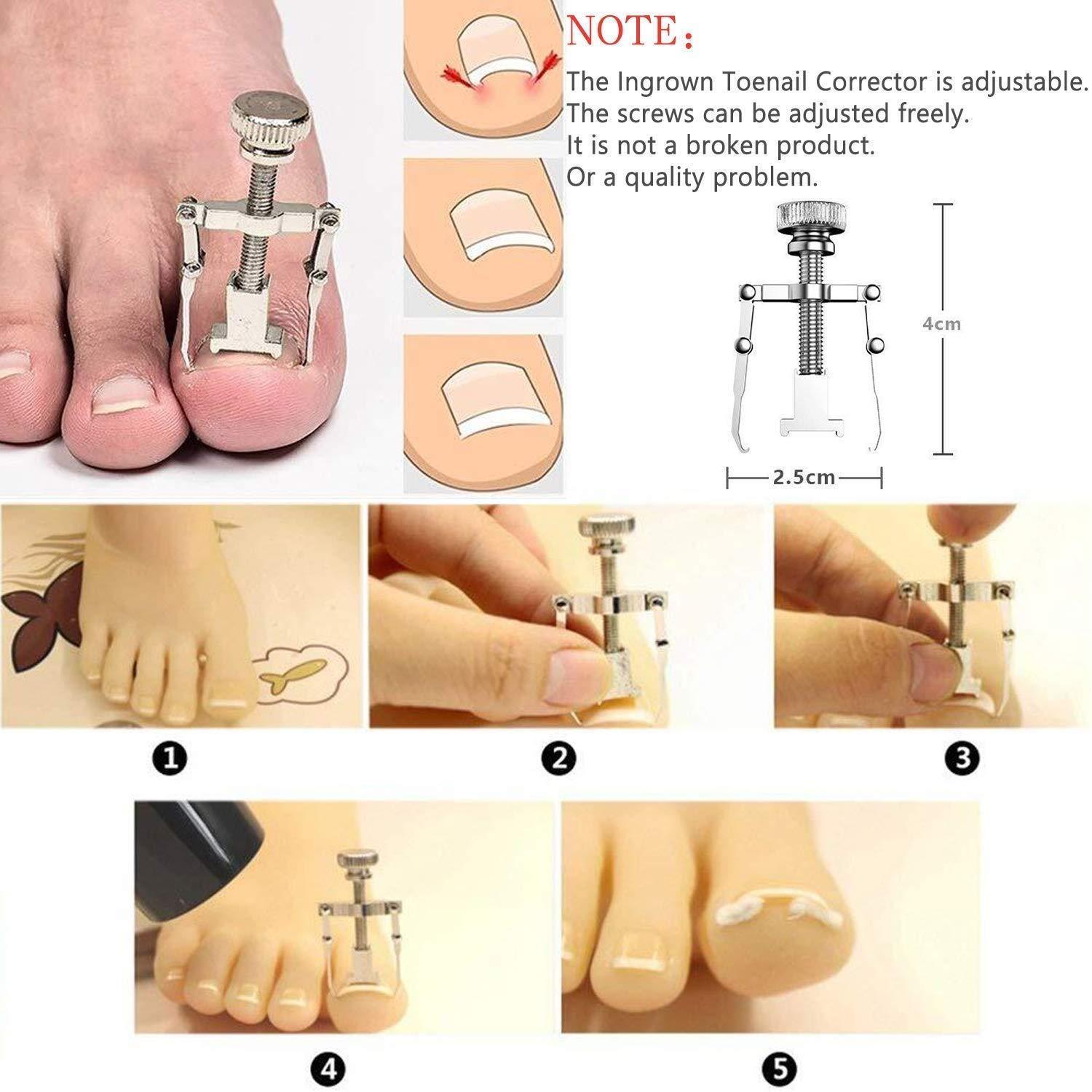 11Pcs/Set Ingrown Toenail Tools Kit Nail Care Pedicure Tools - VirtuousWares:Global