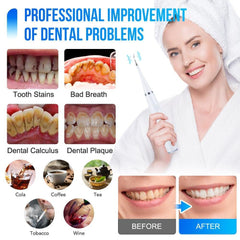 2 in 1 Dental Whitening Electric Tooth Brush Tartar Remover Teeth - VirtuousWares:Global