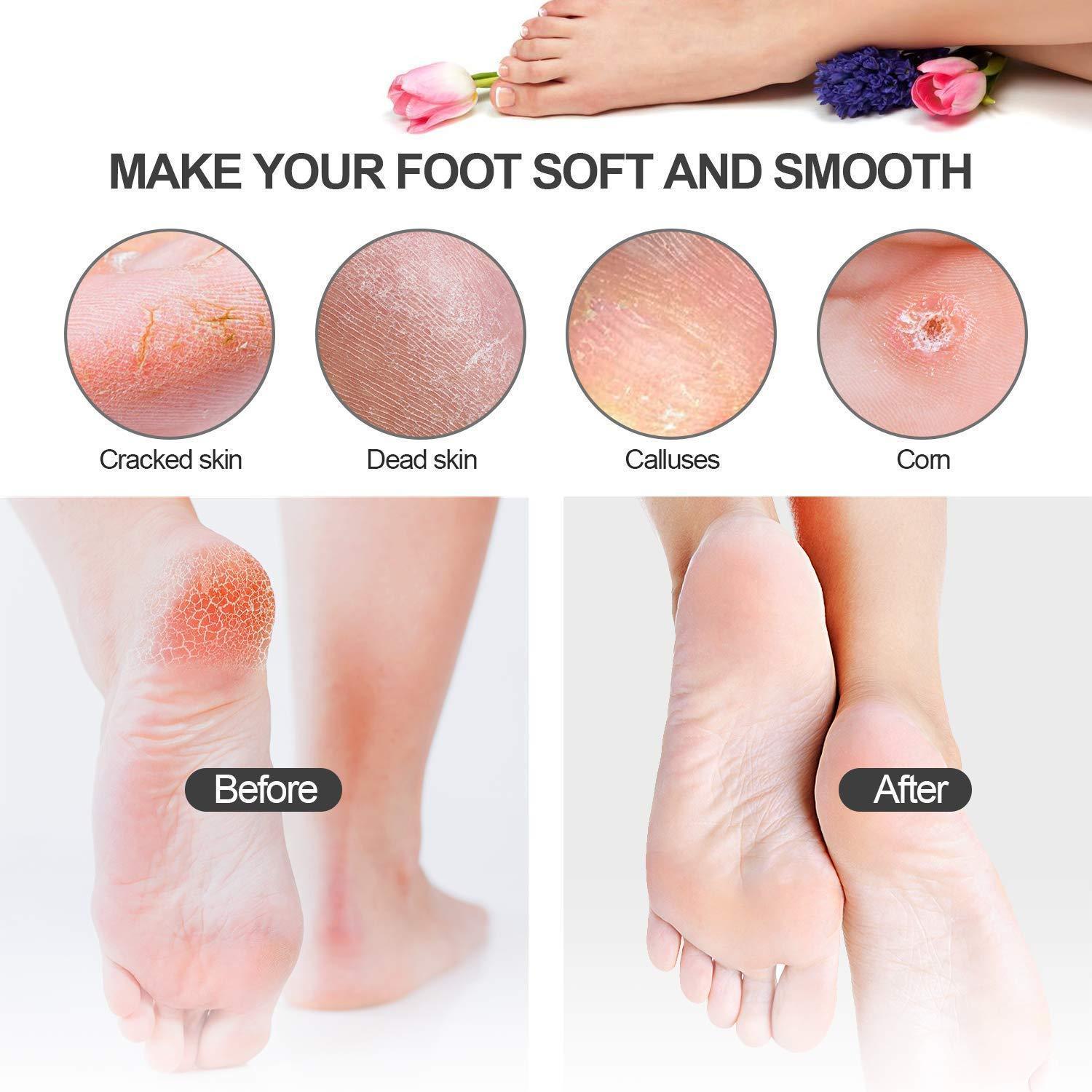 21 in 1 Stainless Steel Professional Pedicure Tools - VirtuousWares:Global