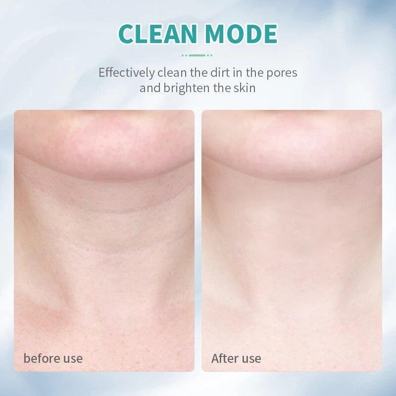 3 Colors Led Facial Neck Massager Photon Skin Tighten Slimming Reduce - VirtuousWares:Global
