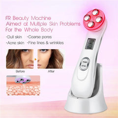 5in1 RF&EMS Radio Mesotherapy Electroporation Face Beauty Pen Radio - VirtuousWares:Global
