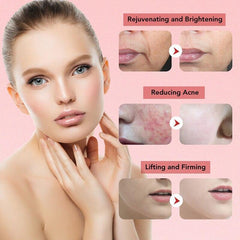 7 In 1 RF Face Massager Skin Rejuvenation Mesotherapy Facial Lifting - VirtuousWares:Global