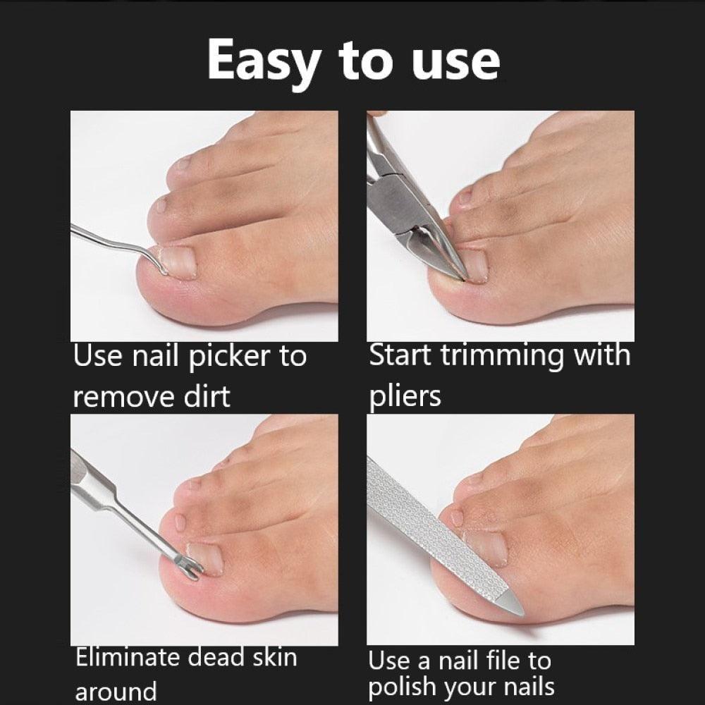 Dead Skin Dirt Remover Pedicure Care Tool Pro - VirtuousWares:Global