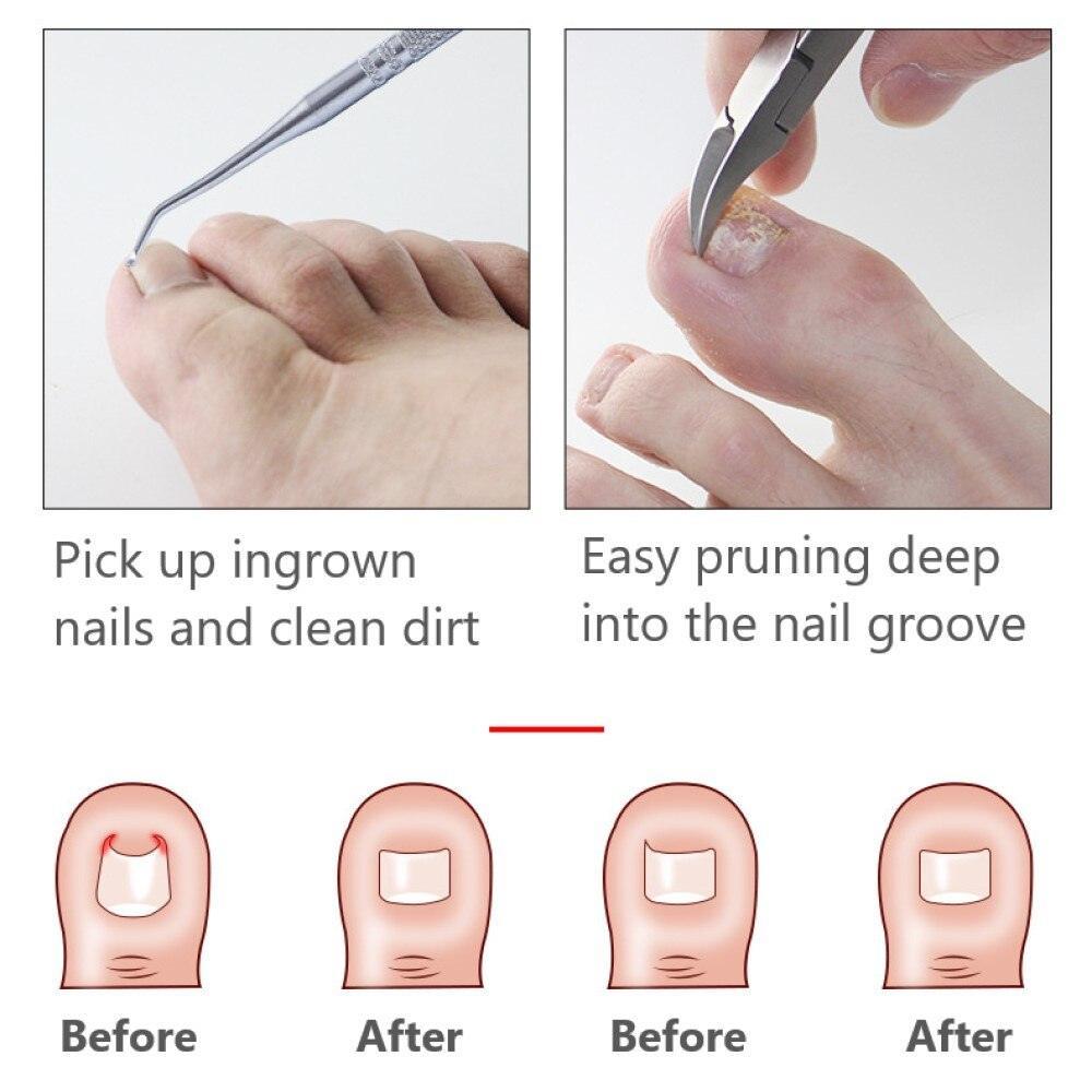 Dead Skin Dirt Remover Pedicure Care Tool - VirtuousWares:Global