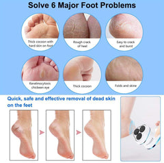 Electric Anti-Callus Foot Rasp with 6 Rollers - VirtuousWares:Global