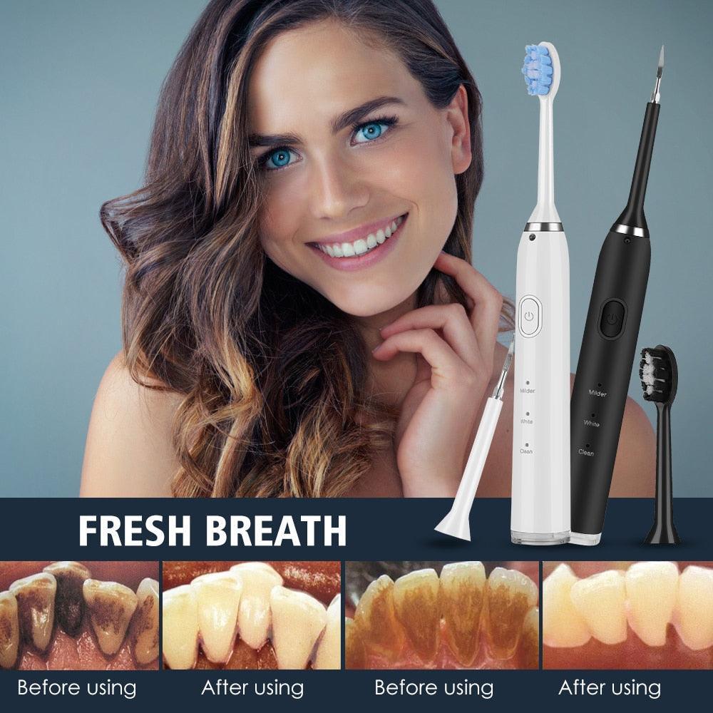 Electric Dental Scaler Teeth Whitening Device Teeth Cleaner - VirtuousWares:Global