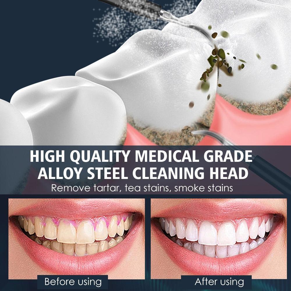 Electric Dental Scaler Teeth Whitening Device Teeth Cleaner - VirtuousWares:Global
