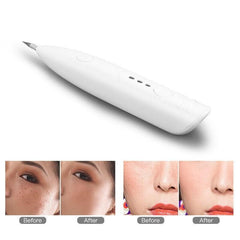 Electric Mini Laser Pen Tattoo Mole Removal Machine Face Care Skin Tag - VirtuousWares:Global
