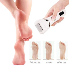 Electric Pedicure Foot Care Tool Files Pedicure Callus Remover - VirtuousWares:Global