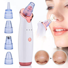 Facial Blackhead Remover Electric Acne Cleaner Blackhead Black Point - VirtuousWares:Global