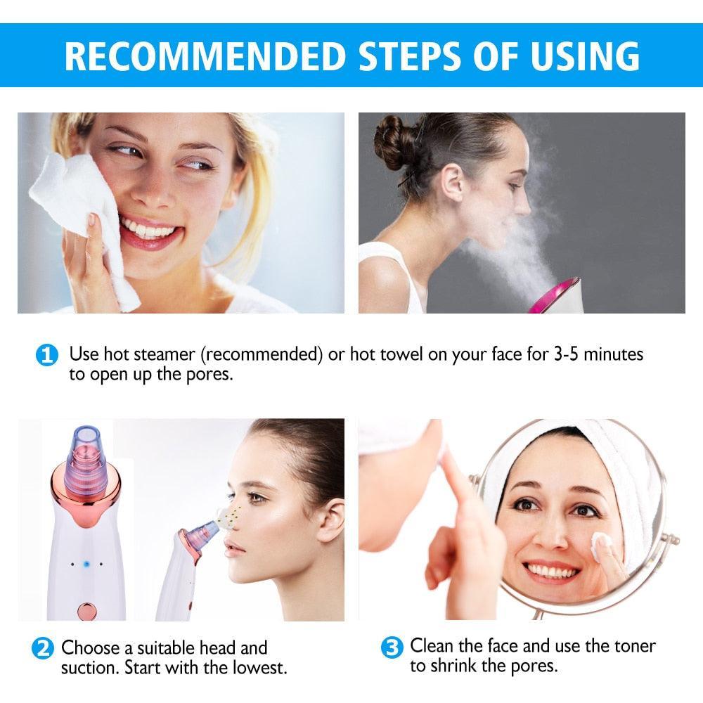 Facial Blackhead Remover Electric Acne Cleaner Blackhead Black Point - VirtuousWares:Global