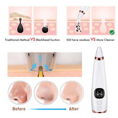 Facial microcry stalline blackhead skin beauty instrument - VirtuousWares:Global