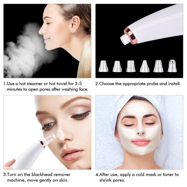 Facial microcry stalline blackhead skin beauty instrument - VirtuousWares:Global
