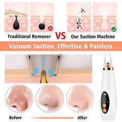 Facial Pore Cleaner Blackhead Remover Vacuum Suction Cleaner Pore Acne - VirtuousWares:Global
