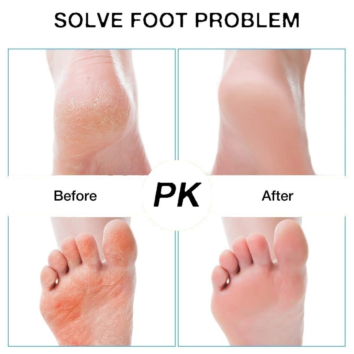 Foot Care Tool with 3 Rollers Skin Care - VirtuousWares:Global