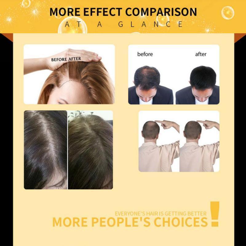 Hair Loss Prevention - Rapid & Natural Hair Growth - VirtuousWares:Global
