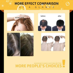 Hair Loss Prevention - Rapid & Natural Hair Growth - VirtuousWares:Global