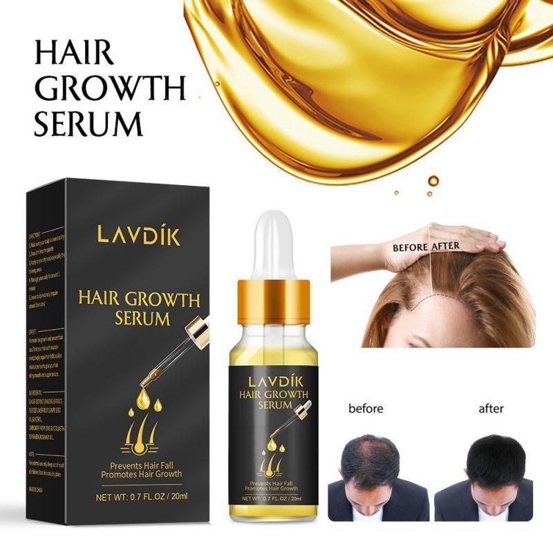 Hair Loss Prevention - Rapid & Natural Hair Growth - VirtuousWares:Global
