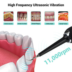 High Frequency Dental Teeth Whitening Electric Tooth Brush For - VirtuousWares:Global