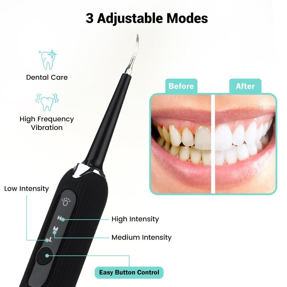 High Frequency Dental Teeth Whitening Electric Tooth Brush For - VirtuousWares:Global