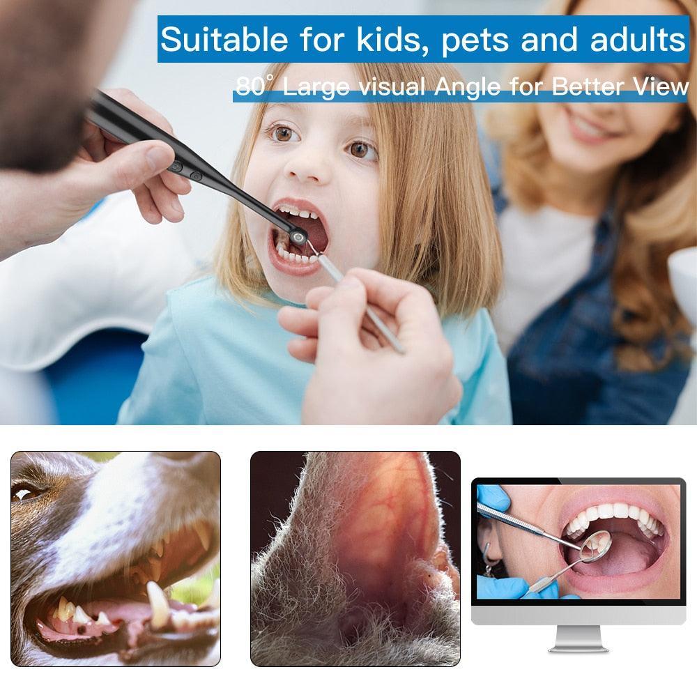 Intraoral Dental Camera Endoscope 720P HD Oral Dental Camera - VirtuousWares:Global