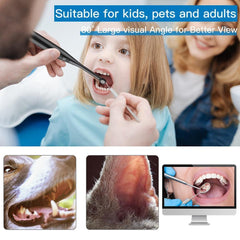 Intraoral Dental Camera Endoscope 720P HD Oral Dental Camera - VirtuousWares:Global