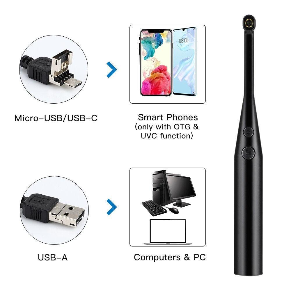 Intraoral Dental Camera Endoscope 720P HD Oral Dental Camera - VirtuousWares:Global