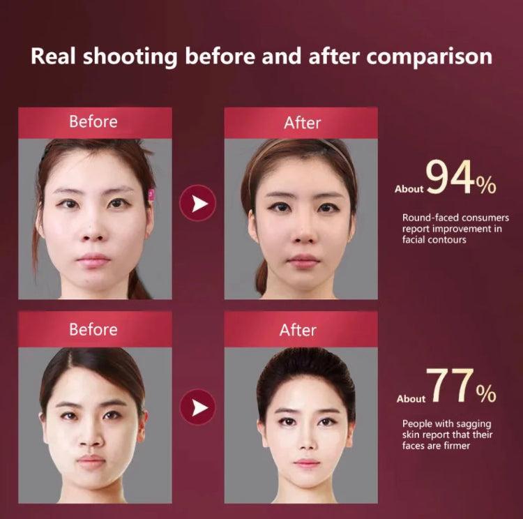 LED Photon Therapy Facial Slimming Massager Facial Lifting Device - VirtuousWares:Global