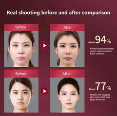LED Photon Therapy Facial Slimming Massager Facial Lifting Device - VirtuousWares:Global
