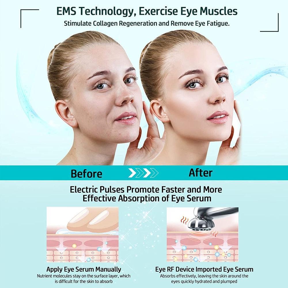 Microcurrent Facial Device RF Radio Frequency Eye Skin Tighten & Anti - VirtuousWares:Global