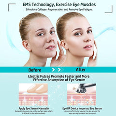 Microcurrent Facial Device RF Radio Frequency Eye Skin Tighten & Anti - VirtuousWares:Global