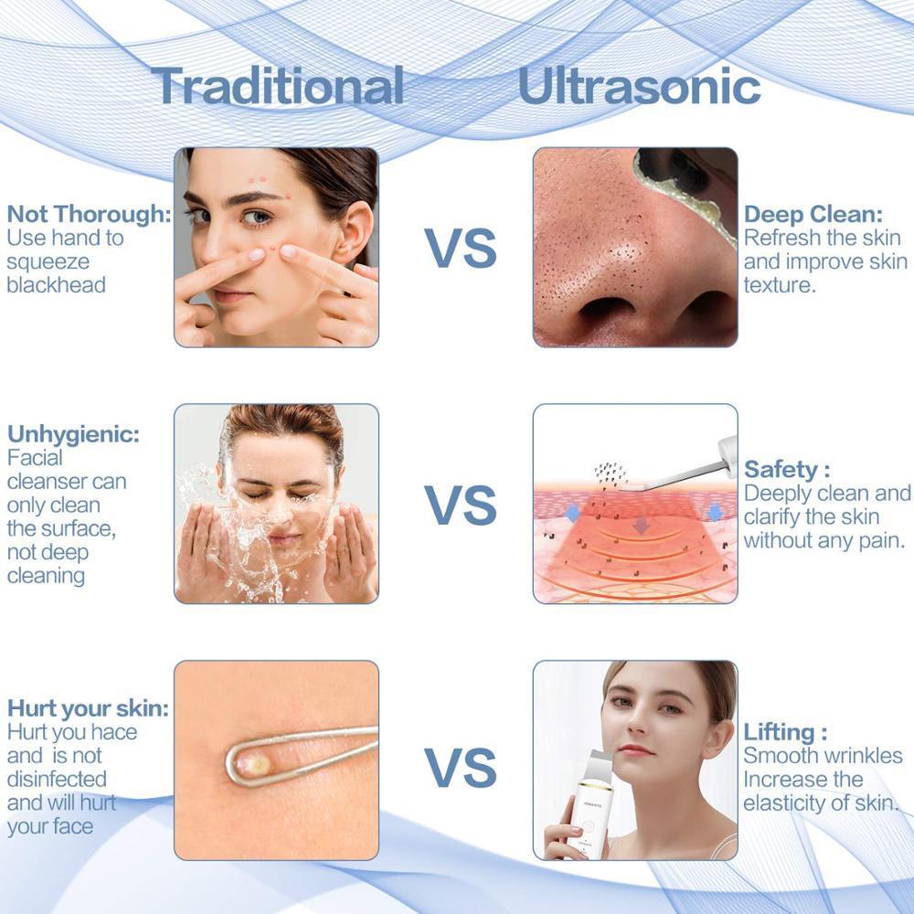 New Ultrasonic Ion Face Cleansing Skin Scrubber Peeling Shovel EMS - VirtuousWares:Global