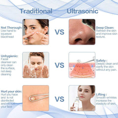 New Ultrasonic Ion Face Cleansing Skin Scrubber Peeling Shovel EMS - VirtuousWares:Global