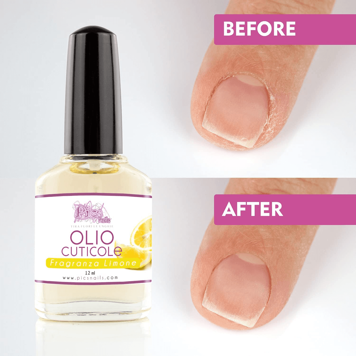 Olio Cuticole Unghie per Mani e Piedi Professionale Limone 12 ml - VirtuousWares:Global