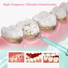 Portable Electric Sonic Dental Scaler Tooth Cleanser Dentist Calculus - VirtuousWares:Global