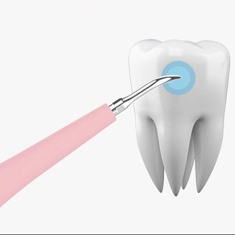 Portable Electric Sonic Dental Scaler Tooth Cleanser Dentist Calculus - VirtuousWares:Global