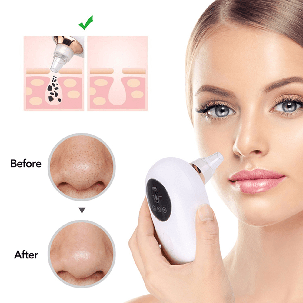 Portable Face Deep Pore Cleaner Vacuum Blackhead Remover - VirtuousWares:Global