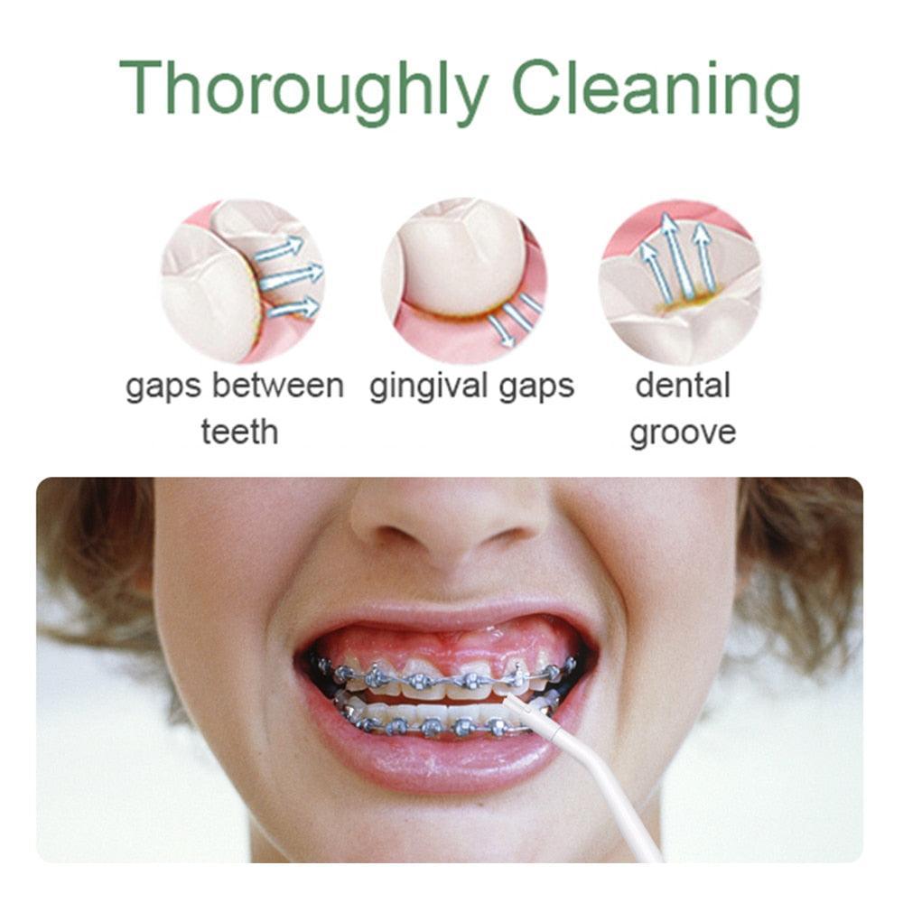 Portable Oral Irrigator Dental Water Flosser Device Thread Teeth - VirtuousWares:Global
