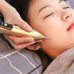 Skin Tag Mole Removal Plasma Pen Black Dot Remover Electric Wart - VirtuousWares:Global
