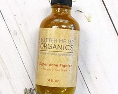 Super Acne Fighter / Organic Acne Treatment / Acne / Essential Oils / - VirtuousWares:Global