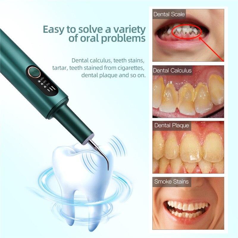 Ultrasonic Dental irrigator Smoke Stain Dental Plaque Cleaner 3 Modes - VirtuousWares:Global