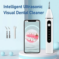 Ultrasonic Dental Scaler Electric Teeth Cleaner for Tooth Whitening - VirtuousWares:Global