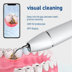 Ultrasonic Dental Scaler Electric Teeth Cleaner for Tooth Whitening - VirtuousWares:Global