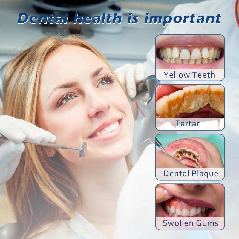 Ultrasonic Dental Scaler Electric Teeth Cleaner for Tooth Whitening - VirtuousWares:Global