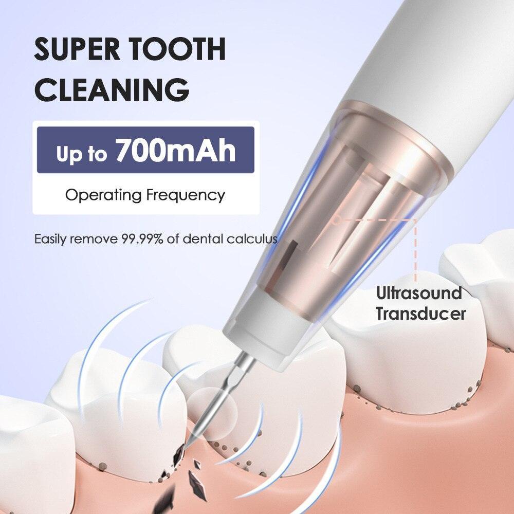 Ultrasonic Dental Scaler Screen Display Electric Sonic Tooth Scaler - VirtuousWares:Global