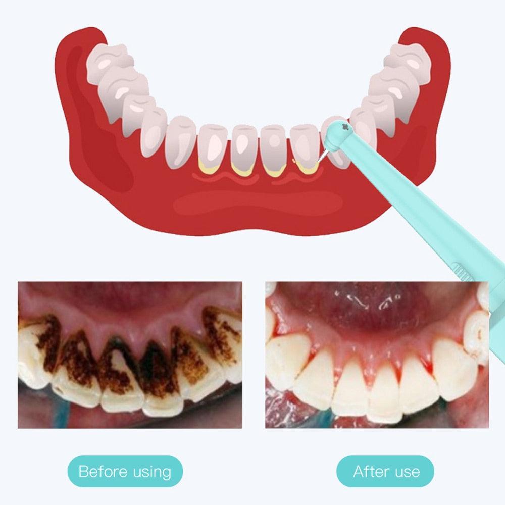 Ultrasonic Dental Washer Portable Dental Scaler USB Rechargeable - VirtuousWares:Global