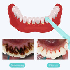Ultrasonic Dental Washer Portable Dental Scaler USB Rechargeable - VirtuousWares:Global
