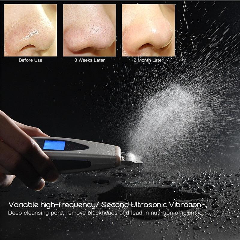 Ultrasonic Skin Scrubber Deep Face Cleaning Machine Remove Dirt - VirtuousWares:Global
