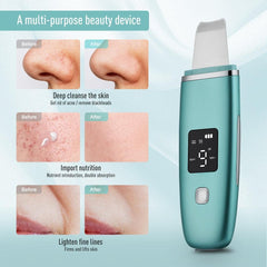 Ultrasonic Skin Scrubber EMS Facial Pore Deep Cleansing Spatula - VirtuousWares:Global