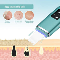 Ultrasonic Skin Scrubber EMS Facial Pore Deep Cleansing Spatula - VirtuousWares:Global